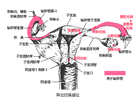 特别是女性朋友还未察觉自己已经停经怀孕,当宫外孕的腹痛发生后,还